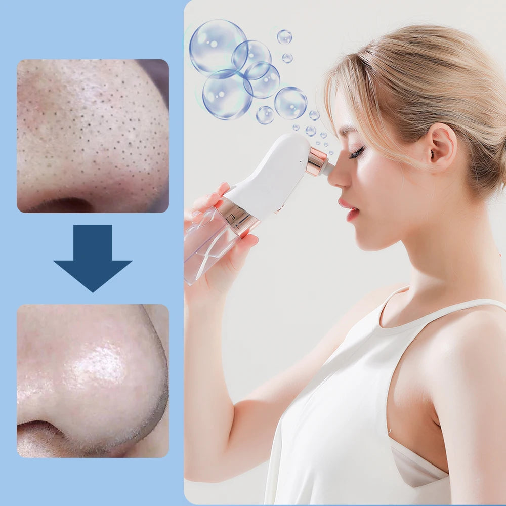 PoreVac™ Blackhead Vacuum Cleaner