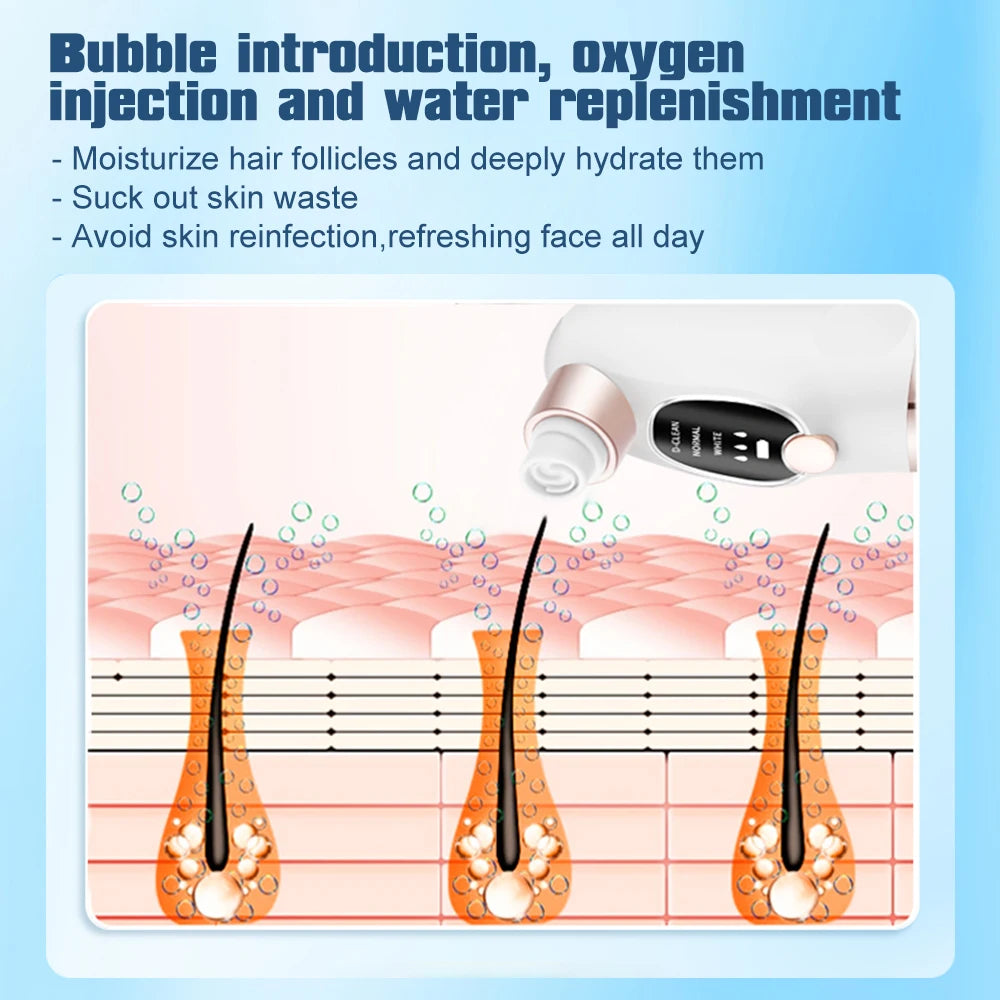 PoreVac™ Blackhead Vacuum Cleaner