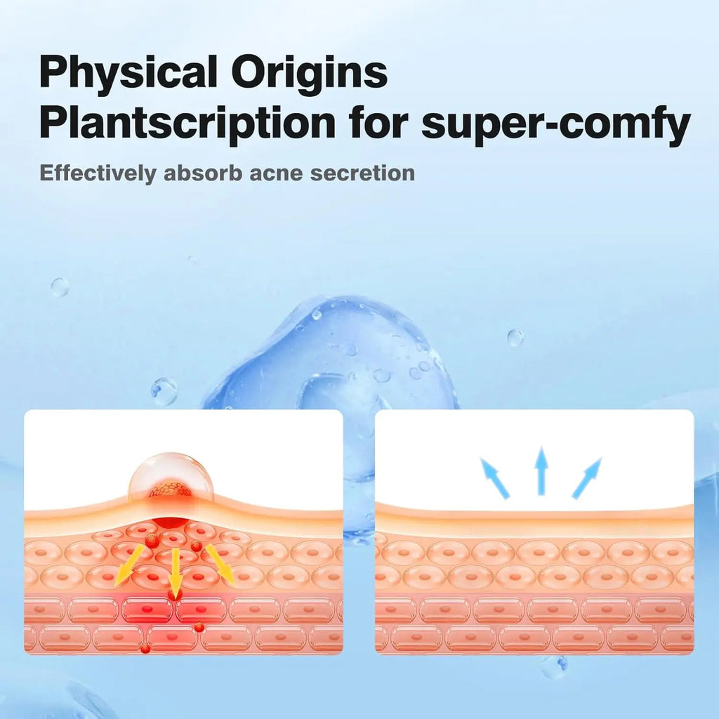 AcneClear™ Hydrocolloid Pimple Patch
